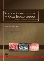 Surgical Complications in Oral Implantology: Etiology, Prevention, and Management (.epub)
