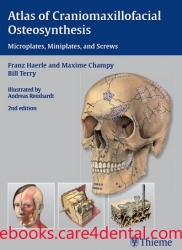 Atlas of Craniomaxillofacial Osteosynthesis: Microplates, Miniplates, and Screws (pdf)