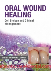 Oral Wound Healing: Cell Biology and Clinical Management (pdf)