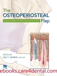 The Osteoperiosteal Flap: A Simplified Approach to Alveolar Bone Reconstruction (.epub)