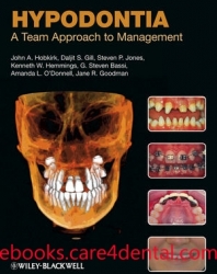 Hypodontia: A Team Approach to Management (pdf)
