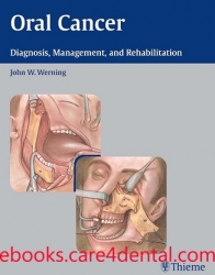 Oral Cancer: Diagnosis, Management, and Rehabilitation (pdf)