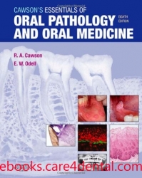 Cawson's Essentials of Oral Pathology and Oral Medicine, 8e (pdf)
