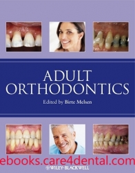 Adult Orthodontics (pdf)