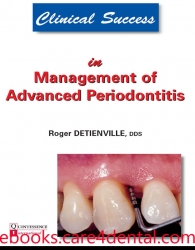 Clinical Success in Management of Advanced Periodontitis (.epub)
