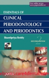 Essentials of Clinical Periodontology and Periodontics, 2nd Edition (pdf)