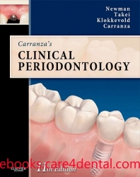 Online Expert Consult Chapters of Carranza’s Clinical Periodontology, 11th Edition (pdf)