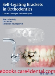 Self-ligating Brackets in Orthodontics: Current Concepts and Techniques (pdf)