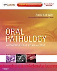 Oral Pathology: A Comprehensive Atlas and Text with EXPERT CONSULT – Online and Print (pdf)