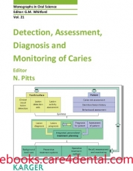 Detection, Assessment, Diagnosis and Monitoring of Caries (pdf)