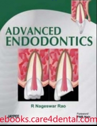 Advanced Endodontics (pdf)
