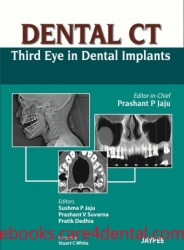 Dental CT: Third Eye in Dental Implants (pdf)
