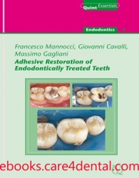 Adhesive Restoration of Endodontically Treated Teeth (.EPUB)
