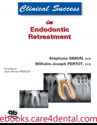 Clinical Success in Endodontic Retreatment  (.EPUB)