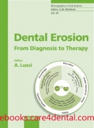 Dental Erosion: From Diagnosis to Therapy (pdf)