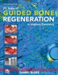 20 Years of Guided Bone Regeneration in Implant Denistry (pdf)