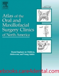 Dental Implants in Children, Adolescents, and Young Adults, An Issue of Atlas of the Oral and Maxillofacial Surgery Clinics (pdf)