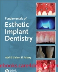 Fundamentals of Esthetic Implant Dentistry (pdf)