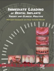 Immediate Loading of Dental Implants: Theory and Clinical Practice (pdf)