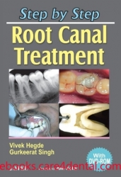 Step by Step® Root Canal Treatment (pdf)