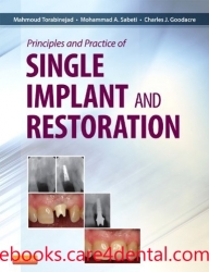 Principles and Practice of Single Implant and Restoration (pdf)