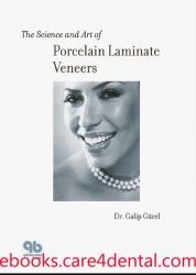 Science and Art of Porcelain Laminate Veneers (pdf)