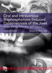 Oral and Intravenous Bisphosphonate–Induced Osteonecrosis of the Jaws: History, Etiology, Prevention, and Treatment, 2nd Edition (EPUB format)
