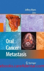 Oral Cancer Metastasis (pdf)