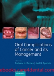 Oral Complications of Cancer and its Management (pdf)