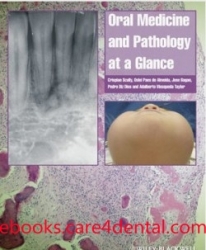 Oral Medicine and Pathology at a Glance (pdf)