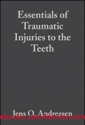 Essentials of Traumatic Injuries to the Teeth: A Step-by-Step Treatment Guide, 2nd Edition