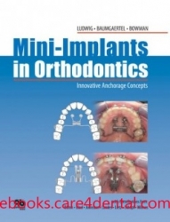 Mini-implants in Orthodontics: Innovative Anchorage Concepts (pdf)