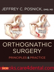 Orthognathic Surgery: Principles and Practice – 2 Volume Set (pdf)
