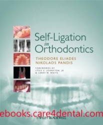 Self-Ligation in Orthodontics (pdf)