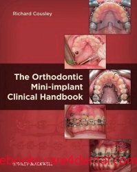 The Orthodontic Mini-implant Clinical Handbook (pdf)