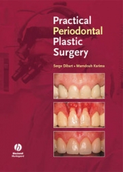 Practical Periodontal Plastic Surgery (pdf)