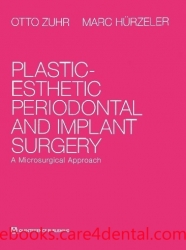 Plastic-Esthetic Periodontal and Implant Surgery: A Microsurgical Approach (pdf)