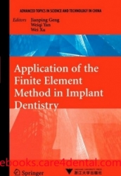Application of the Finite Element Method in Implant Dentistry (pdf)
