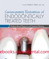Contemporary Restoration of Endodontically Treated Teeth (pdf)