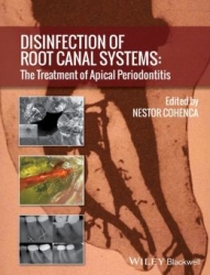 Disinfection of Root Canal Systems: The Treatment of Apical Periodontitis (pdf)