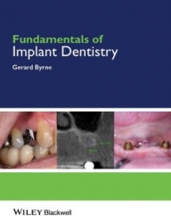 Fundamentals of Implant Dentistry (pdf)