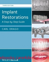 Implant Restorations: A Step-by-Step Guide, 3rd edition (pdf)