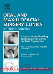 Alveolar Bone Grafting Techniques for Dental Implant Preparation, An Issue of Oral and Maxillofacial Surgery Clinics (pdf)