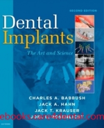 Dental Implants: The Art and Science, 2nd Edition (pdf)