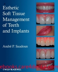 Esthetic Soft Tissue Management of Teeth and Implants (pdf)