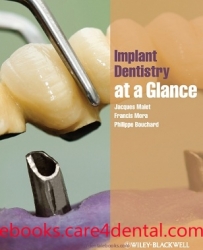 Implant Dentistry at a Glance (pdf)