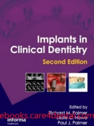 Implants in Clinical Dentistry, 2nd Edition (pdf)