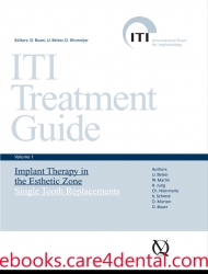 ITI Treatment Guide, Vol 1: Implant Therapy in the Esthetic Zone for Single-Tooth Replacements (.epub)