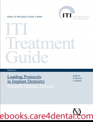 ITI Treatment Guide, Vol 2: Loading Protocols in Implant Dentistry—Partially Dentate Patients (.epub)