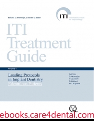 ITI Treatment Guide, Vol 4: Loading Protocols in Implant Dentistry: Edentulous Patients (.epub)